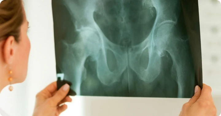 Mobile pelvic and hip X-ray after a fall